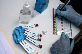 A worker uses a rapid HIV-AIDS test.